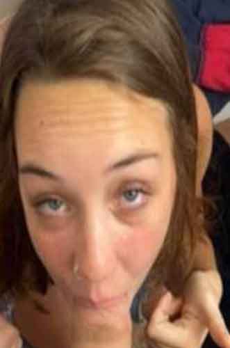 Lina, 35 år